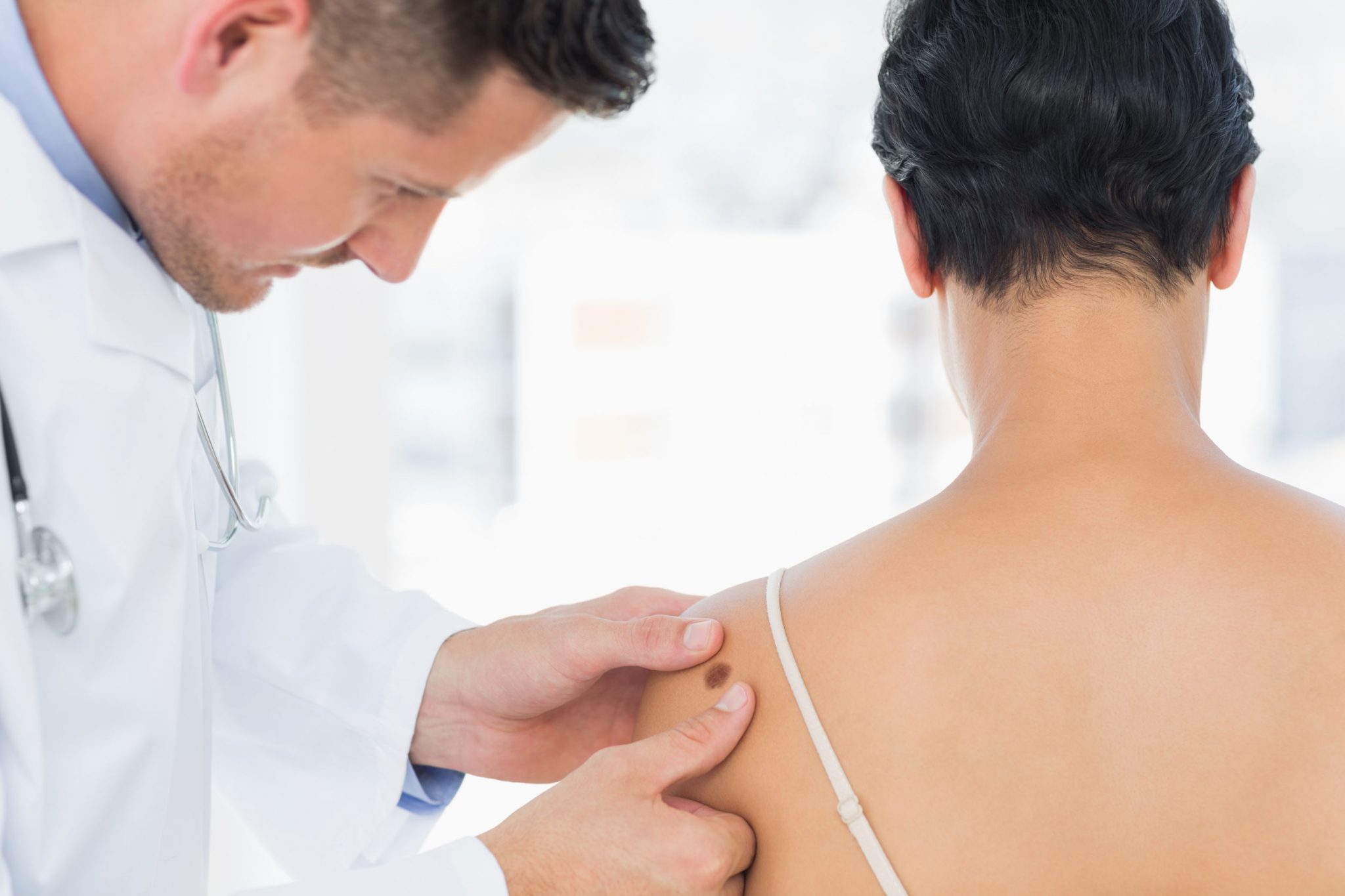 Melanoma