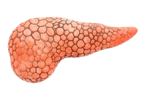 câncer de pâncreas