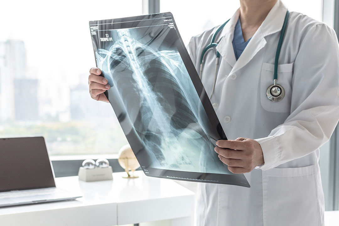 Pneumologista em Belo Horizonte - MG