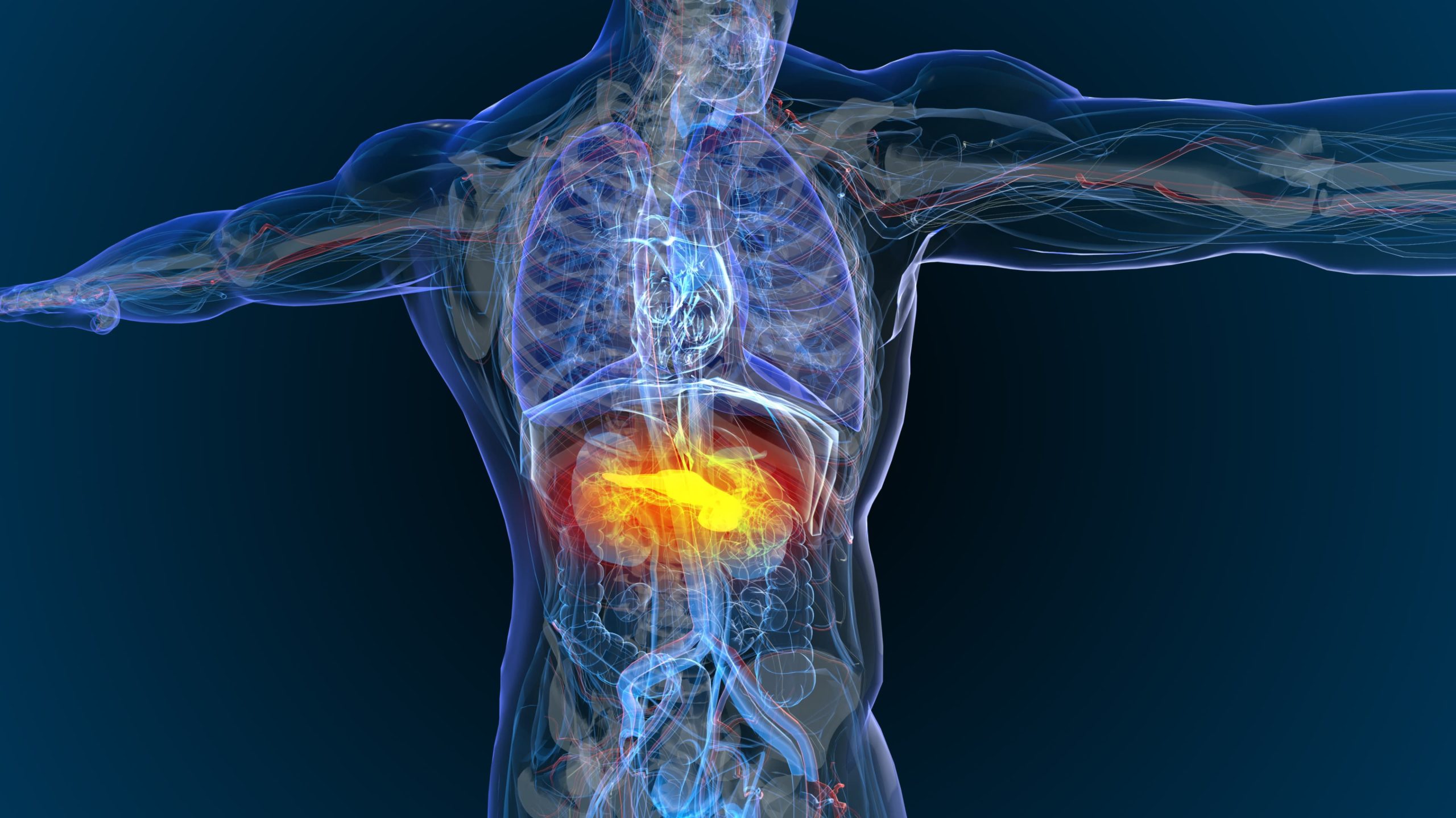 câncer no pâncreas