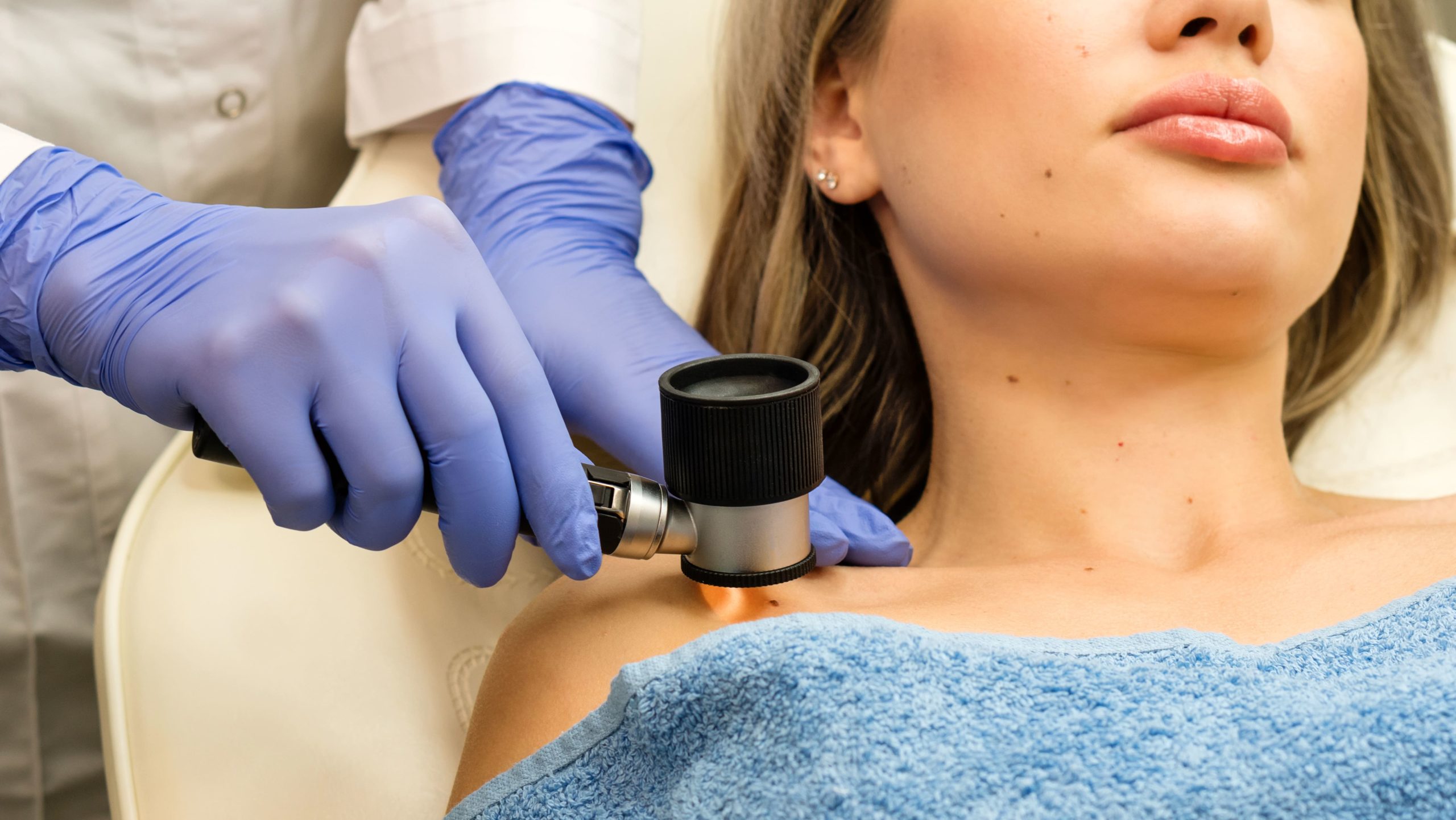 Dermatoscopia