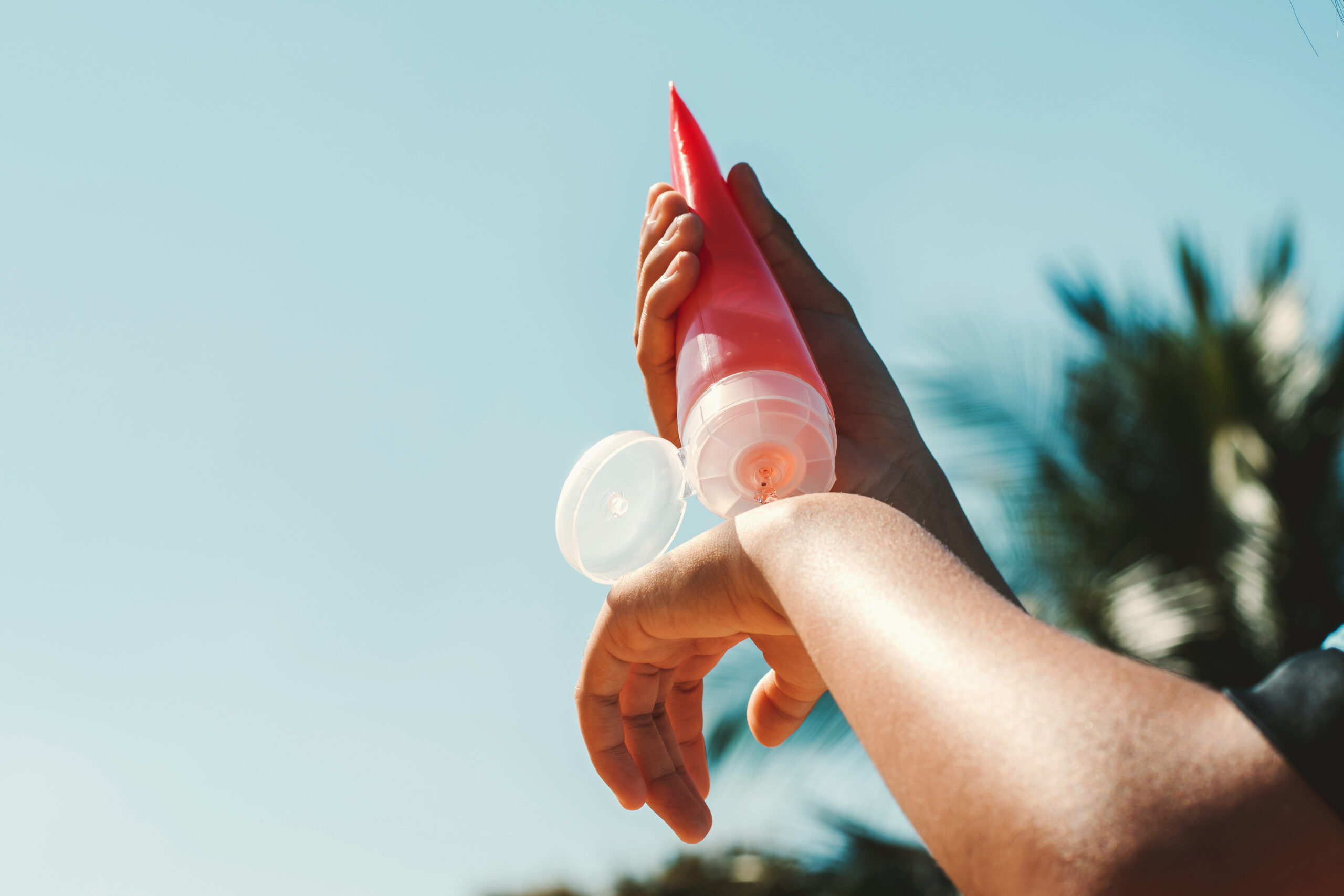 Pessoa aplicando protetor solar no braço como prevenção contra o câncer de pele no verão.