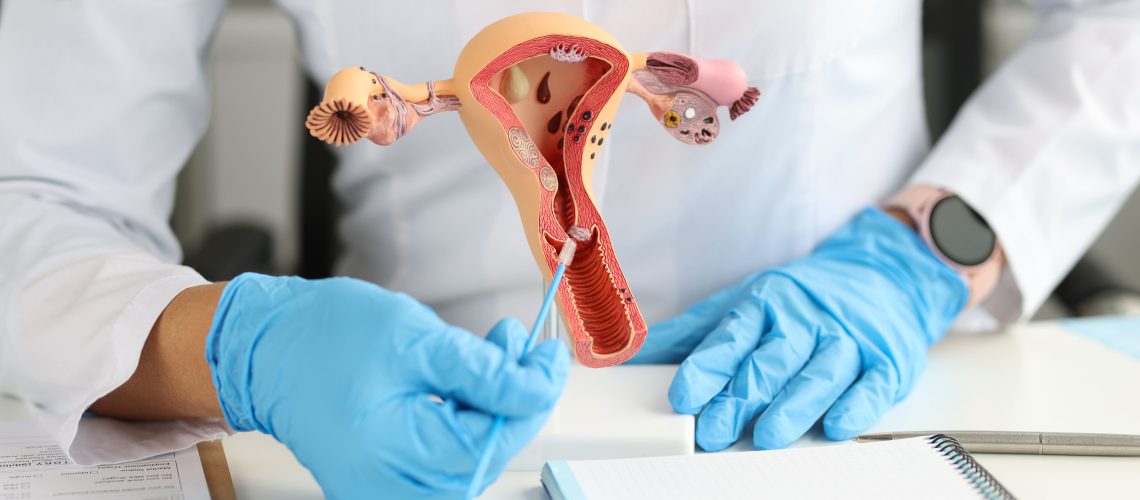 Câncer Ginecológico