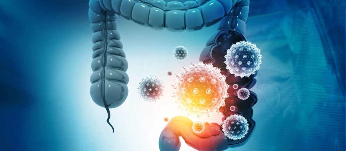 Câncer Gastrointestinal