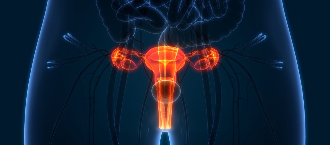 Câncer Ginecológico