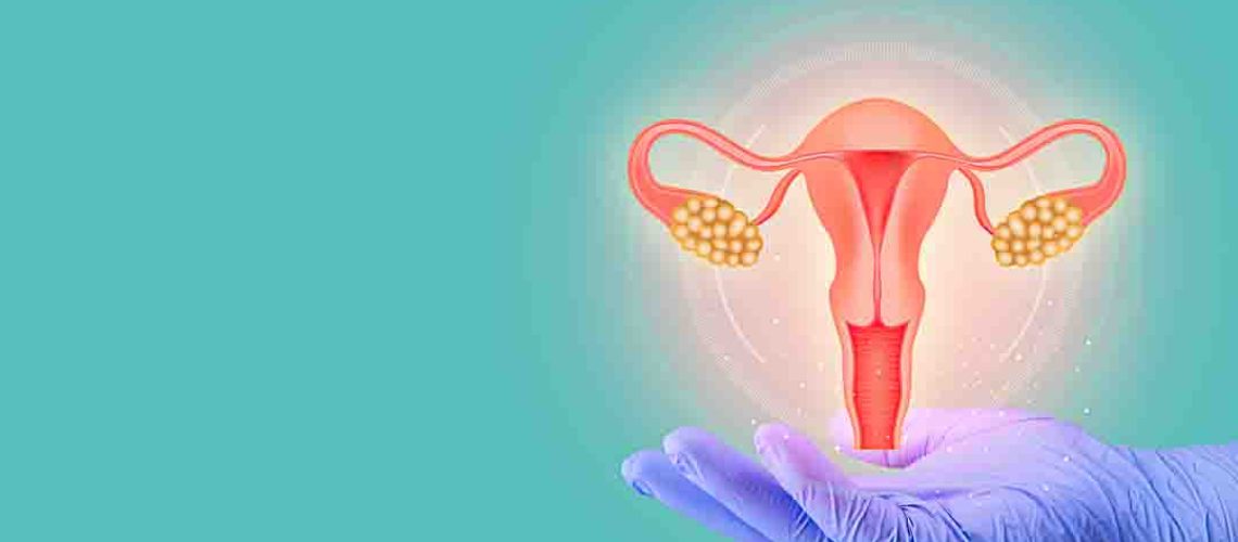 Female reproductive health concept. endometriosis, PCOS, gynecol
