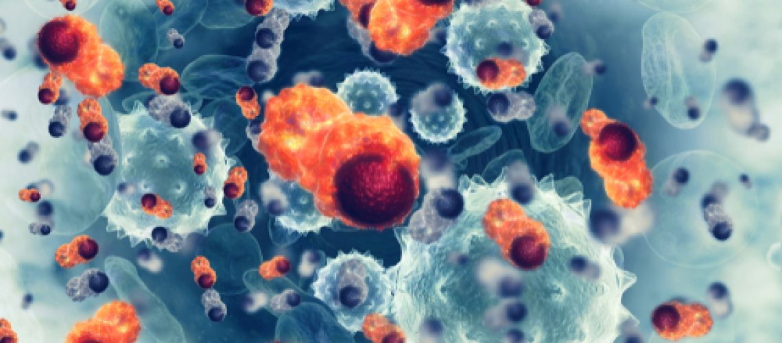 Carcinoma basocelular