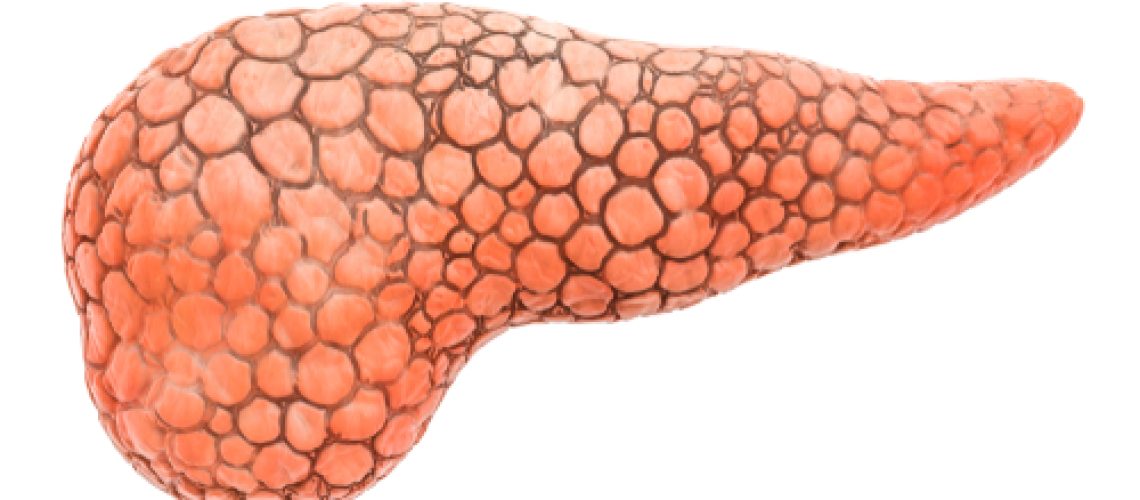 câncer de pâncreas